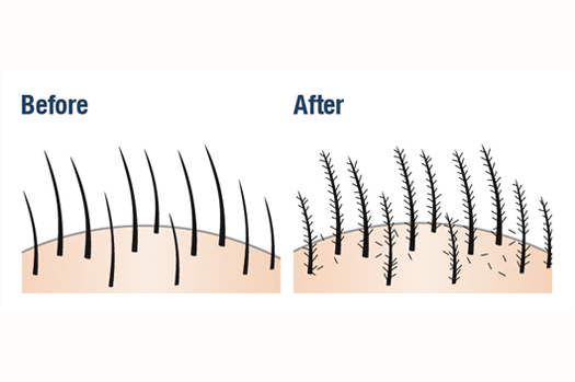 Nanogen Hair Thickening fibres 15gm - Image 2